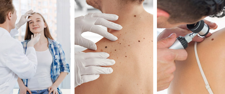Visita dermatologica