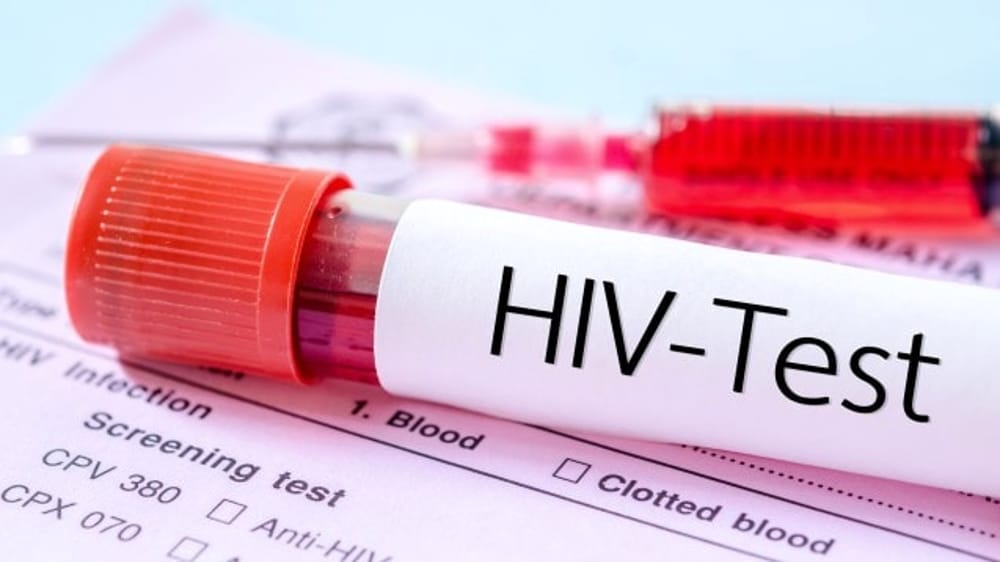 hiv tet
