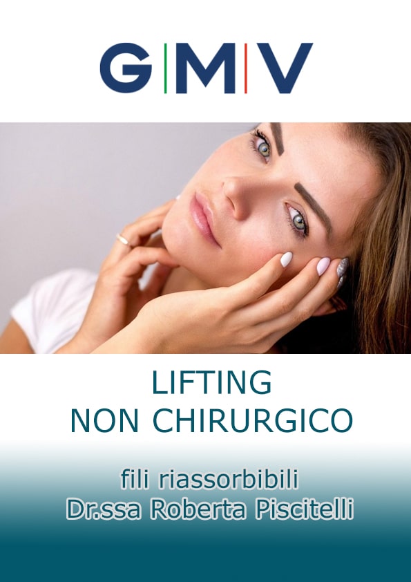 vorso di fili GMV